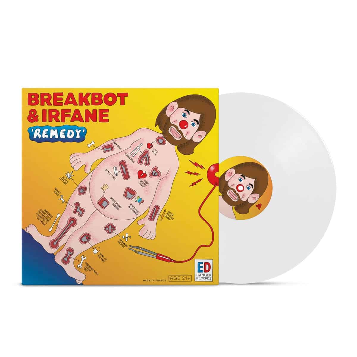 Breakbot & Irfane - Remedy (12